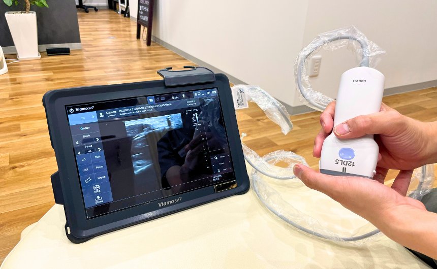 院内に導入している超音波画像観察装置