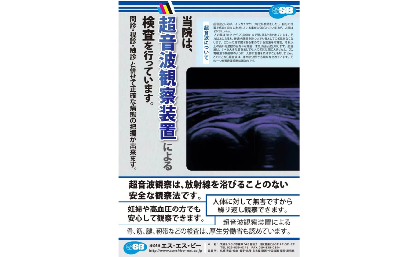 超音波画像観察装置のプローブ